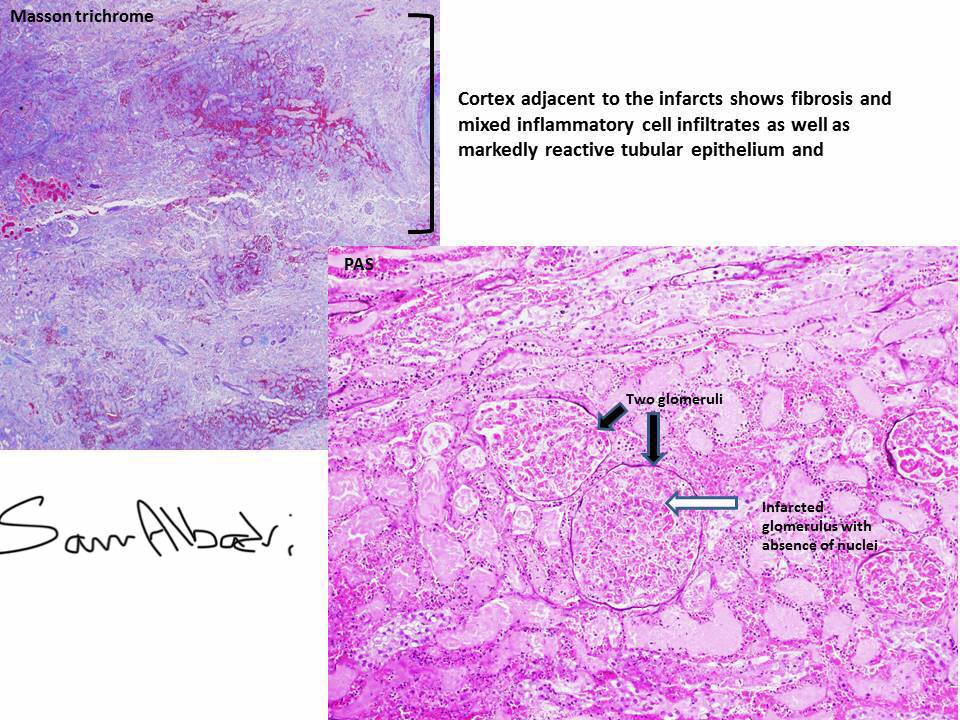 MPAlexanderMD tweet picture