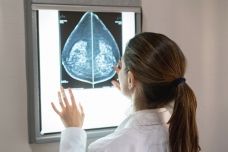 "Using AI to predict breast cancer and personalize care' buff.ly/2Lsaucp
Amazing to see the life-saving benefits of AI/ Deep Learning!