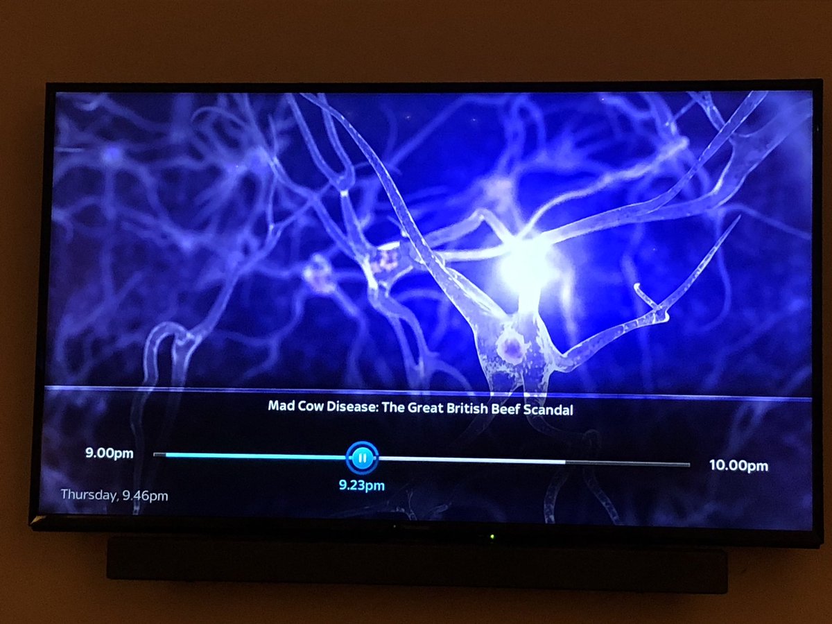 ChrisDuffBeatty's tweet photo. Watching my work on @bbctwo tonight on a documentary about CJD or Mad Cow Disease. A subject close to my families heart as Sporadic CJD claimed my Mum in 2010. We've been involved with the #curecjd campaign ever since. #animation #prn100 #medicalvision #pharmaceutical #bbc2 https://t.co/dEj9xzlEmy