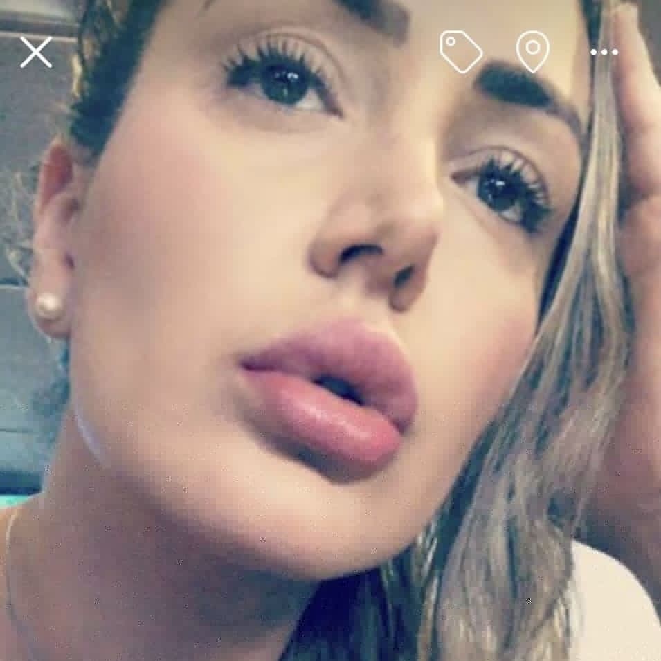 DrSpiegel's tweet photo. What's a bigger complement than sharing your fab results?
#sharingiscaring
#bestinjectorinboston #bestlips #bestlipfillers #lipfillers
Which #filler is this? #versalips #restylanelips #juvedermlips
https://t.co/hlY2cCaK8m https://t.co/v7R1hFxlbW