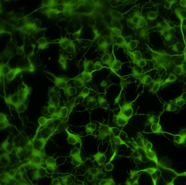 Chris_M_Reid's tweet image. Big thanks to @TheSilverLab for showing me how to dissociate and culture primary neural progenitors!! Grew out some really pretty neurons ( the ones I managed not to contaminate 🙄) #cshlcourses #developmentalneuroscience #ATMN