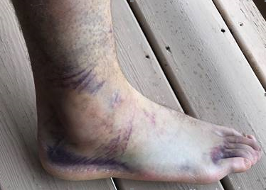 BKlements's tweet photo. Brian Klements Glass Ankles vol-8.

The walking dead. https://t.co/NMpmvtQdPI