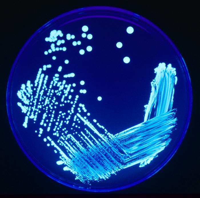 h2olabcheck's tweet photo. here are 8 interesting facts about legionella 
https://t.co/Kk3nsv5OoZ https://t.co/uyy43N0Zex
