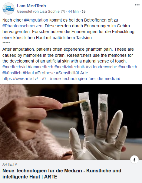 BVMed's tweet photo. #MedTech-Video der Woche: #Phantomschmerzen werden durch Erinnerungen im Gehirn hervorgerufen. Forscher nutzen die Erinnerungen für die Entwicklung einer künstlichen Haut mit natürlichem Tastsinn: https://t.co/8HW1ZBbRBE #medtechvid #iammedtech #medizintechnik #videoderwoche https://t.co/PEYiAZZIYd
