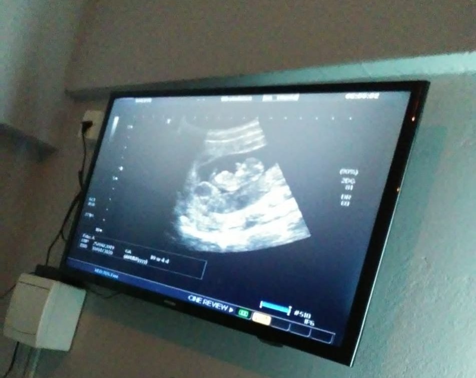 luizauwn_'s tweet photo. Eu não canso de te ver amor da mãe 😍🤰🏽 #gerandoamor https://t.co/pV3lVtOTmD