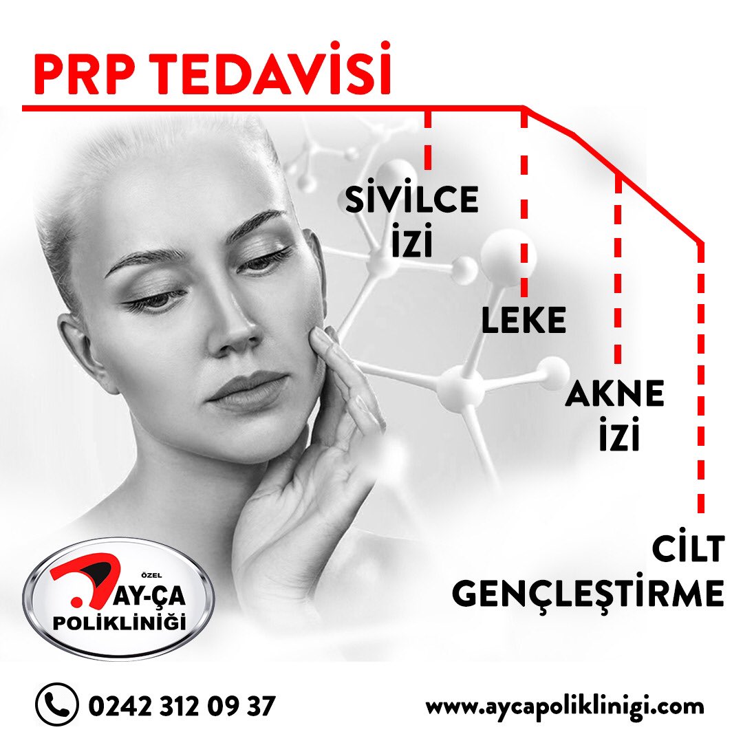 Cildinizi PRP ile gençleştirin 

Detaylı bilgi & Randevu için;
📞0242 3120937
📩info@aycapoliklinigi.com

#prp #prpcilt #antalya #akneizi #leketedavisiantalya #antalyaprp #prpciltyenileme #prpantalya #leketedavisi #plateletrichplasma #leke #ciltgençleştirmeantalya #cumartesi