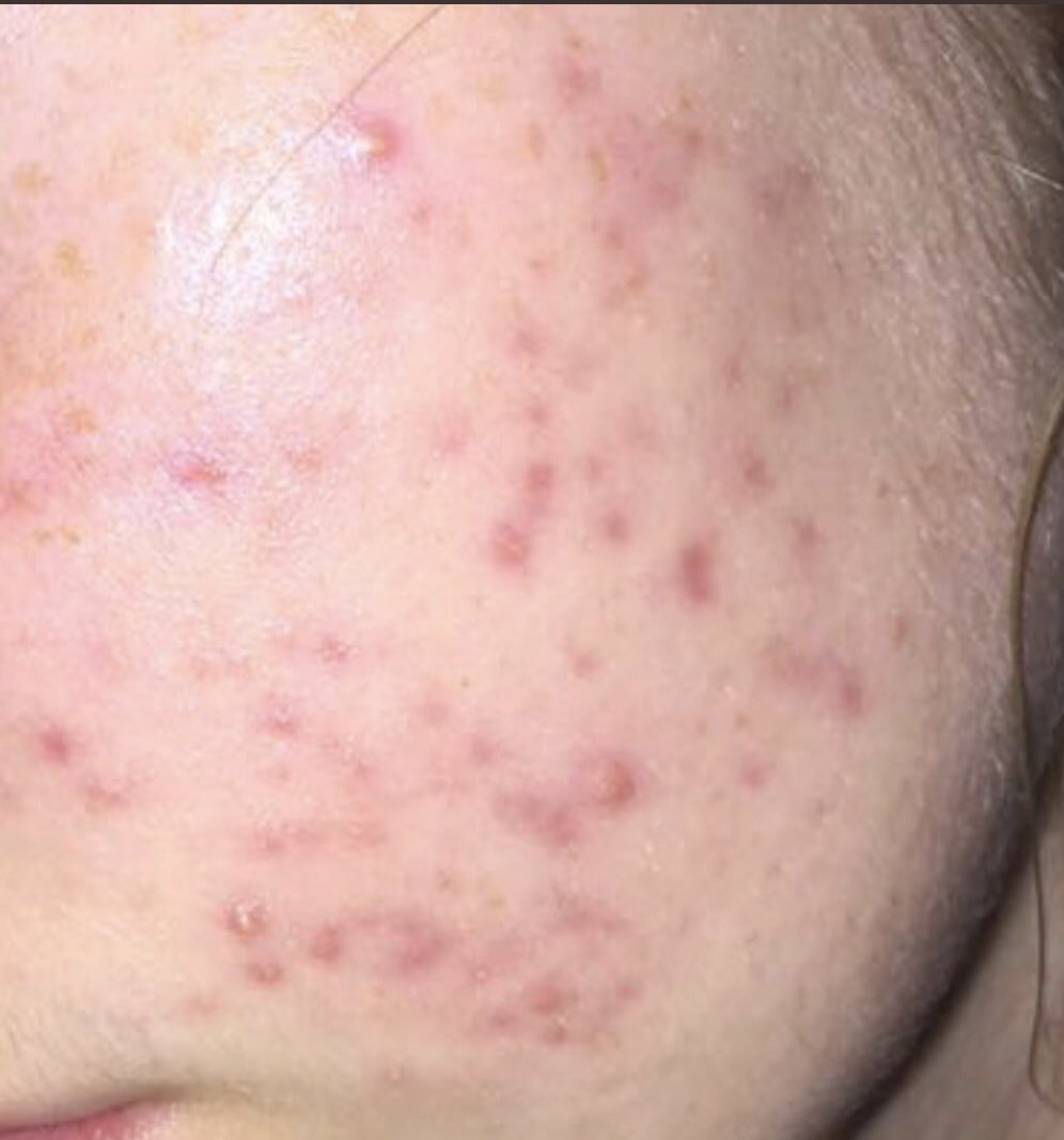 Leandro Kohlhoff tweet media