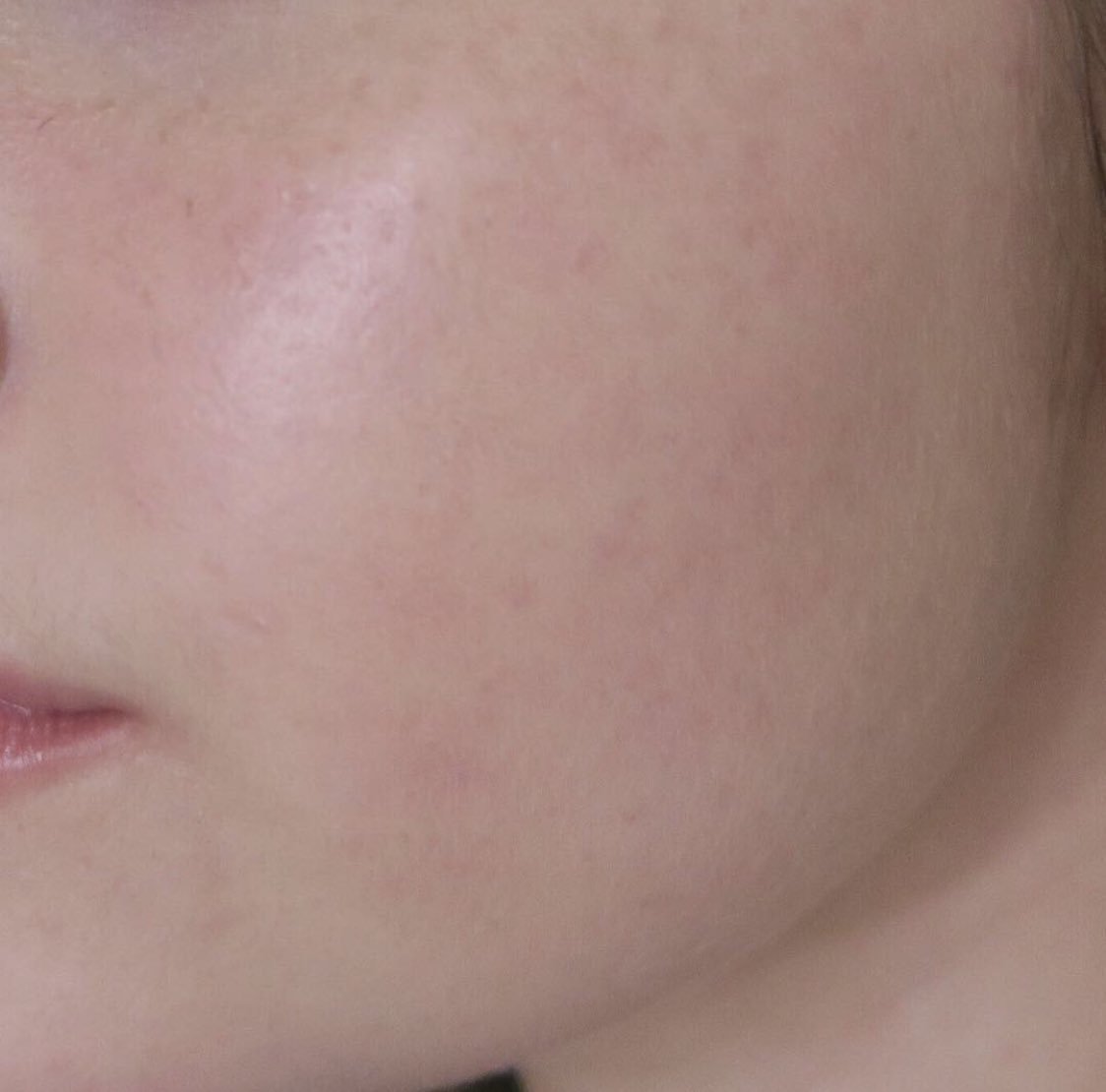 RT PARA PELE FICAR CLARA, LIMPA E BOA SORTE