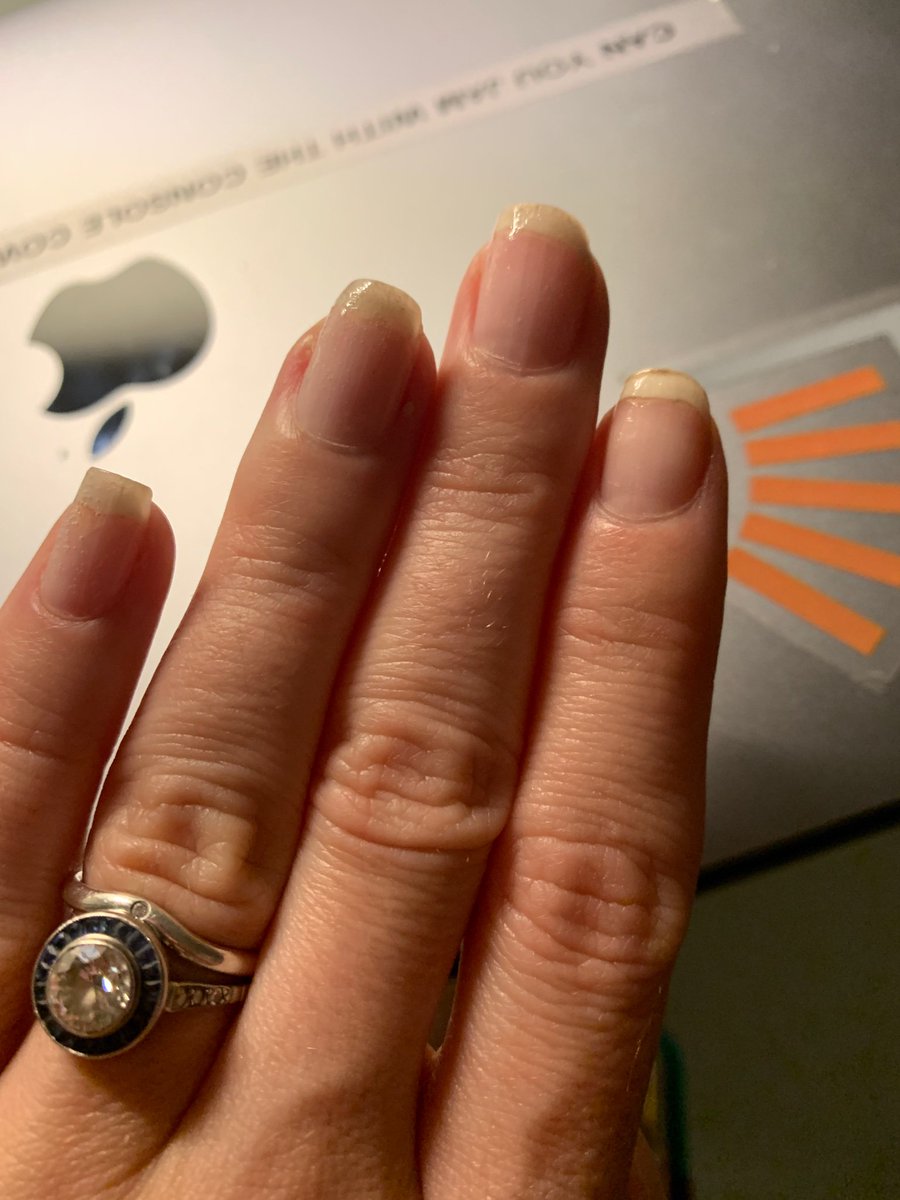 SaraJChipps's tweet image. My #coderclaws are plain but these are the longest I’ve been able to get my nails naturally! I’m super proud of them.