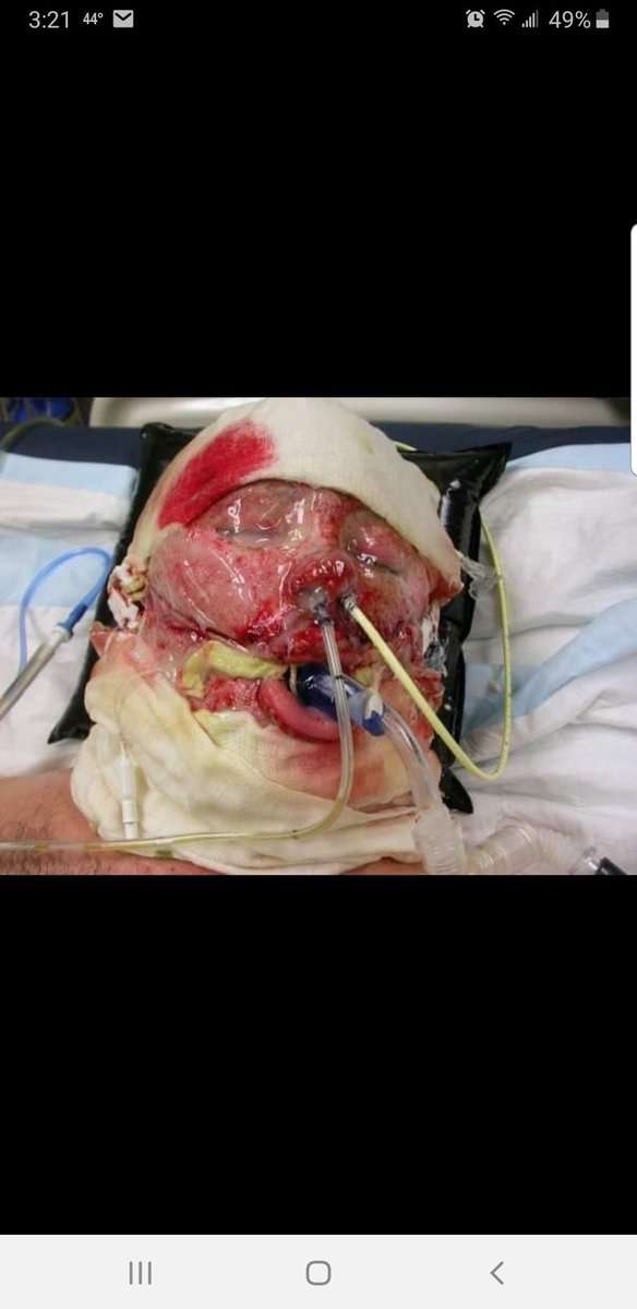 codeofvets's tweet photo. Are you ready to support this American Hero Nick Mapson and his family? His wife is in need of medical care for Cushing Syndrome-not covered by insurance. She will not live if not treated. She is his caregiver & support. Nick needs her. #DrTheodoreFriedman
https://t.co/QFfJFFwJPe https://t.co/KsUzSQOqFT