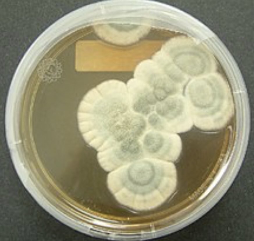 ares_cu's tweet photo. A recent study has shown that mold can survive 200 times the amount of radiation that would be fatal to humans! The Aspergillus and Penicillium molds are the most common molds to grow on the space station and they can cause respiratory infections. #SpaceFactFriday #CUBoulderARES https://t.co/g3FajEwtIL