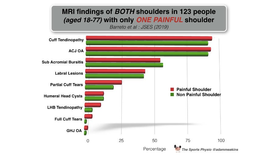 Another study showing just as many things seen on MRIs scans in PAINFUL shoulders are also seen in PAIN FREE shoulders... ncbi.nlm.nih.gov/pubmed/31279721 #DontTreatTheScan #TreatTheHuman