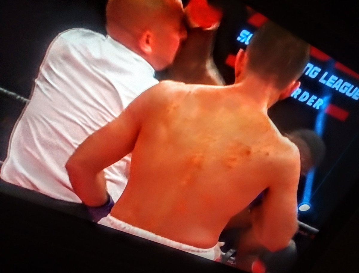 IrishCconMMA's tweet photo. What a bizzare fight 🤨🤔😅
#SamuelPeter with multiple lowblow warnings, repeatedly ignoring & then bloodying up the #ref before refusing to fight!
#AmirKhan next! 🥊🥊
#Heavyweight #Boxing #Fury #poorref https://t.co/VitJ5hVwLM