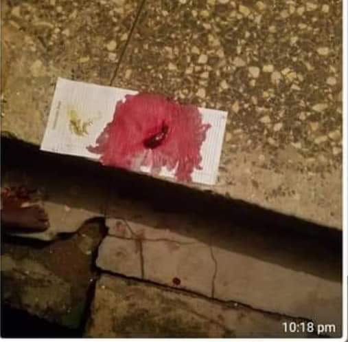 BennyMOF's tweet photo. Pics of a 7yr old raped by a 58yr old will break you 💔😭💔💔💔💔💔💔💔💔💔💔💔💔

This is the highest level of wickedness. How do we protect our kids from these madness happening every day gosh?😭💔😭💔 https://t.co/hzH79qB6cf