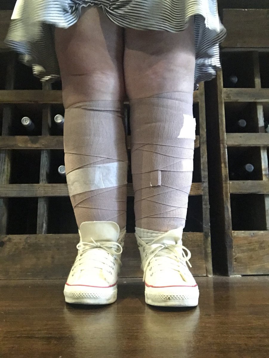 Day 1 - Diagnosis
Lymphedema silagh.wordpress.com/2019/07/12/day…