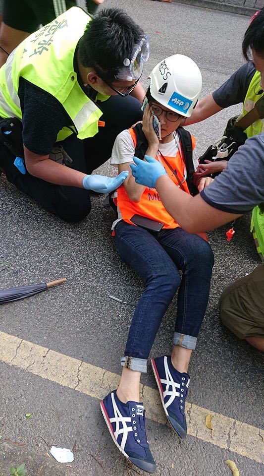 galileocheng's tweet photo. Bravo @hkpoliceforce you assaulted @AFP reporter with baton on face via 黑警大檸樂！ 法新社記者被警棍打面 嚴重瘀青
https://t.co/JgxARVFzHu #AntiELAB #ExtraditionBill #HongkongProtest https://t.co/gEQlYboLnJ