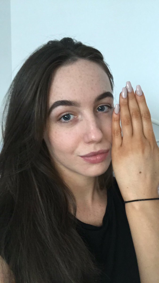 mollward's tweet photo. I’ve made some silly mistakes in my life but this... is the biggest one yet. #TanningFail https://t.co/KIwjR24efp