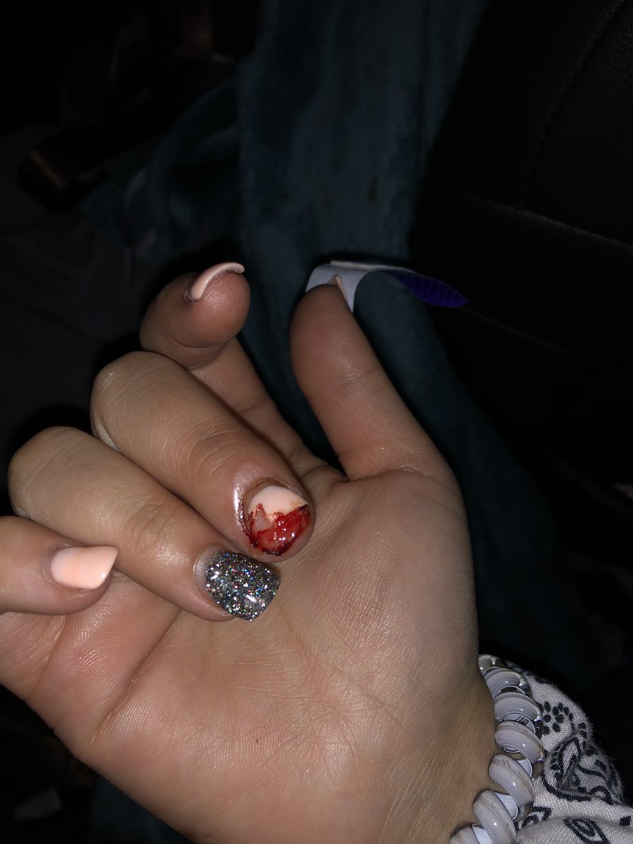 libbybaxterrr_'s tweet photo. i literally have the WORST luck ever. like fml dude. 😩 https://t.co/hFAnavbEaV