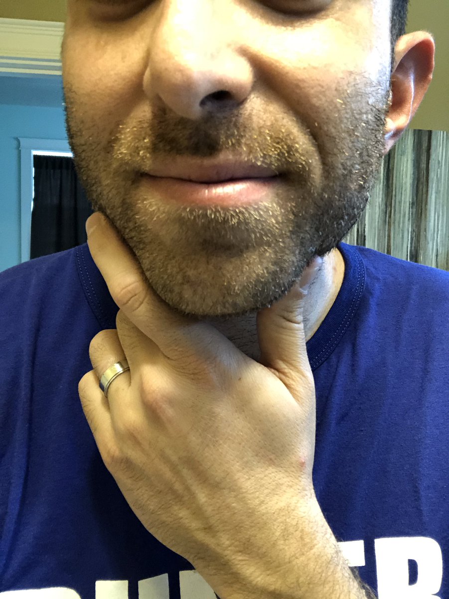 SchreiberEvan's tweet photo. RT = LOVE IT!
❤️ = LOSE IT!
Back to work at @KATUNews on Monday and feeling indecisive about my facial hair — I’m sure my bosses will decide for me, though. #SoPortland 🧔🏻 https://t.co/u4TFcU3BMe