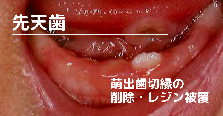 DENTAL YOUTH／歯科医師国家試験／CBT／歯学部向け個別指導塾 on 