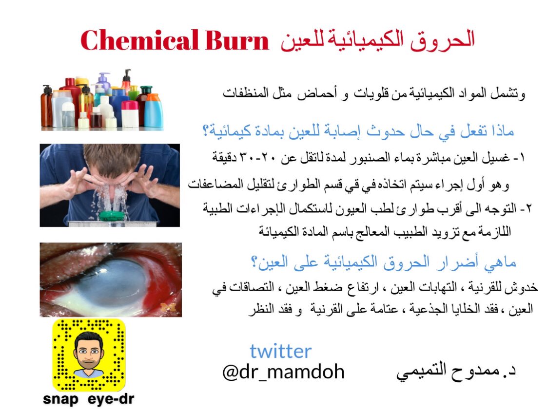 dr_mamdoh's tweet photo. الحروق الكيميائية للعين 

ماذا تفعل في حال الإصابة بها ؟

ماهي أضرارها على العين ؟

 حفظ الله الجميع من كل مكروه 

#اطباء_العالم 
@Consumer_Eye @co_aw1 https://t.co/zuF10Xwv1J