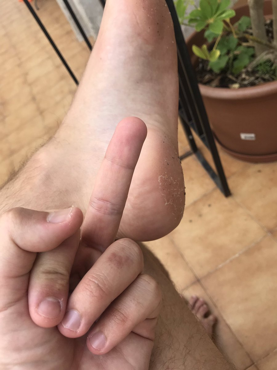 MasterJake96's tweet image. Goodmorning fags! Who’s gonna make my day? Here’s my #reimbursementopportunities:
🍷 £15
🚬 £10
🍕 £30 
🧳 £100  
👟 £50 
🧦 £8 
Paypal me. Even small pathetic tips are welcome
#findom #alphamaster #cashpig #gaycashpig #feet #cashmaster #walletrape #walletdrain #greedy #weakfag