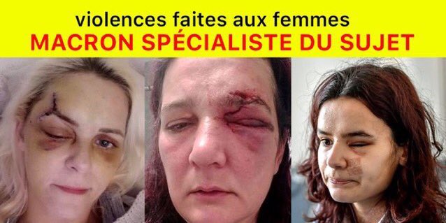 boujemaa_b's tweet photo. @CMilfaq @NatFripouille @birgit4453 #Macron lache ses #trolls #botsRusses #14juillet #destitution #fachosDeLaREM #benalla #france vendue et pourrie. Vive les #giletsJaunes #homard #nyssen #kholer #crase #hulot #acte36 @EstherBenbassa @Qofficiel @jdd @lemondefr @fabricearfi @EliseLucet @edwyplenel @Lanceursalertes https://t.co/Mv5aQrPzvW