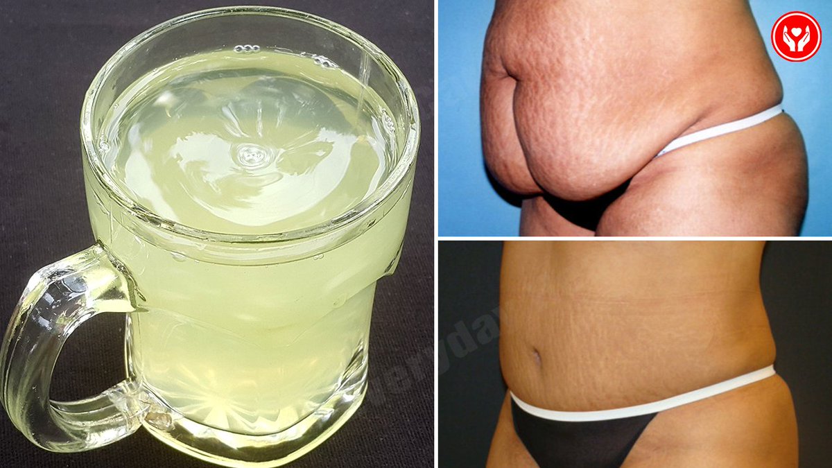 EverydayHeath's tweet photo. How to Lose Belly Fat Fast With Garlic - Natural Remedies For Weight Loss
Click on this link to know how to do it:
https://t.co/igu3kFVqIG
#Loseweight
#Howtolosebellyfatnaturally
#Everydayhealthcare https://t.co/tOiw4lLmX4