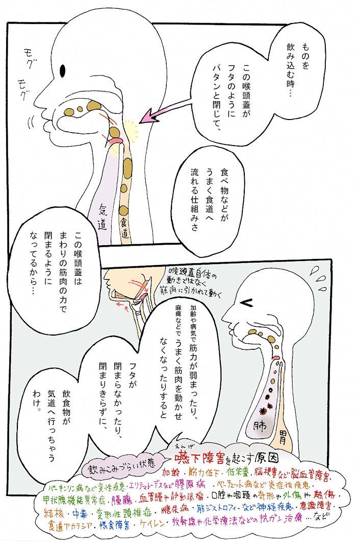 【誤嚥性肺炎】
ごえん性肺炎(概論)でした!
今回これで終わりです🌠
トロミ剤は薬局、ドラッグストア、大型スーパーの介護用品売場などでも売っています。機会あれば試しに飲んでみてください(大抵はあまり美味しく感じません…💦)
#ギリギリ人生web漫画 