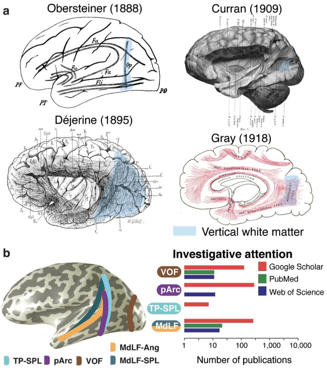 furranko's tweet photo. Associative white matter connecting the dorsal and ventral posterior human cortex https://t.co/jpd9lbPZL3 Associated cloud services and data.  https://t.co/wWZjCCRKta @BrainLifeio @OSFramework @aina_puce @bacaronIU @ScientificData See also https://t.co/3y3zVYmDoR https://t.co/va9CvjNG8H