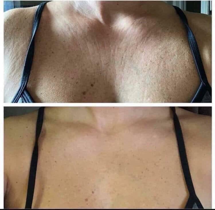 JenniferPeglow's tweet photo. #christmasinjuly #SundayFunday ✅Wow just look at what Firm has done for these ladies! 
✅Why are you still waiting⁉️
PM me! https://t.co/9abHaAM4on