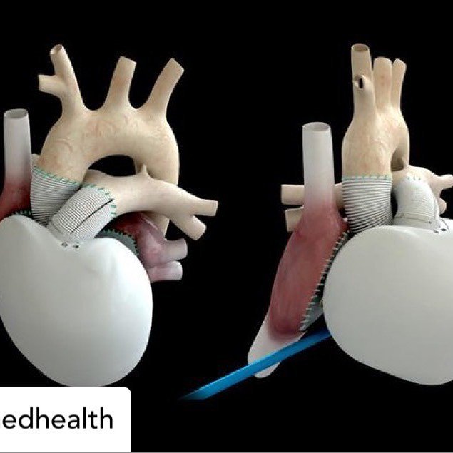 3dheals's tweet photo. Posted @withrepost • @novamedhealth 3D printing is accelerating the way we understand and practice medicine, offering greater anatomical compatibility and surgical comfort! #novamed #healthtech#technology #fourthindustrialrevolution#jamaica #caribbe… https://t.co/0ATwxATAcc https://t.co/9vSsSmtnLq