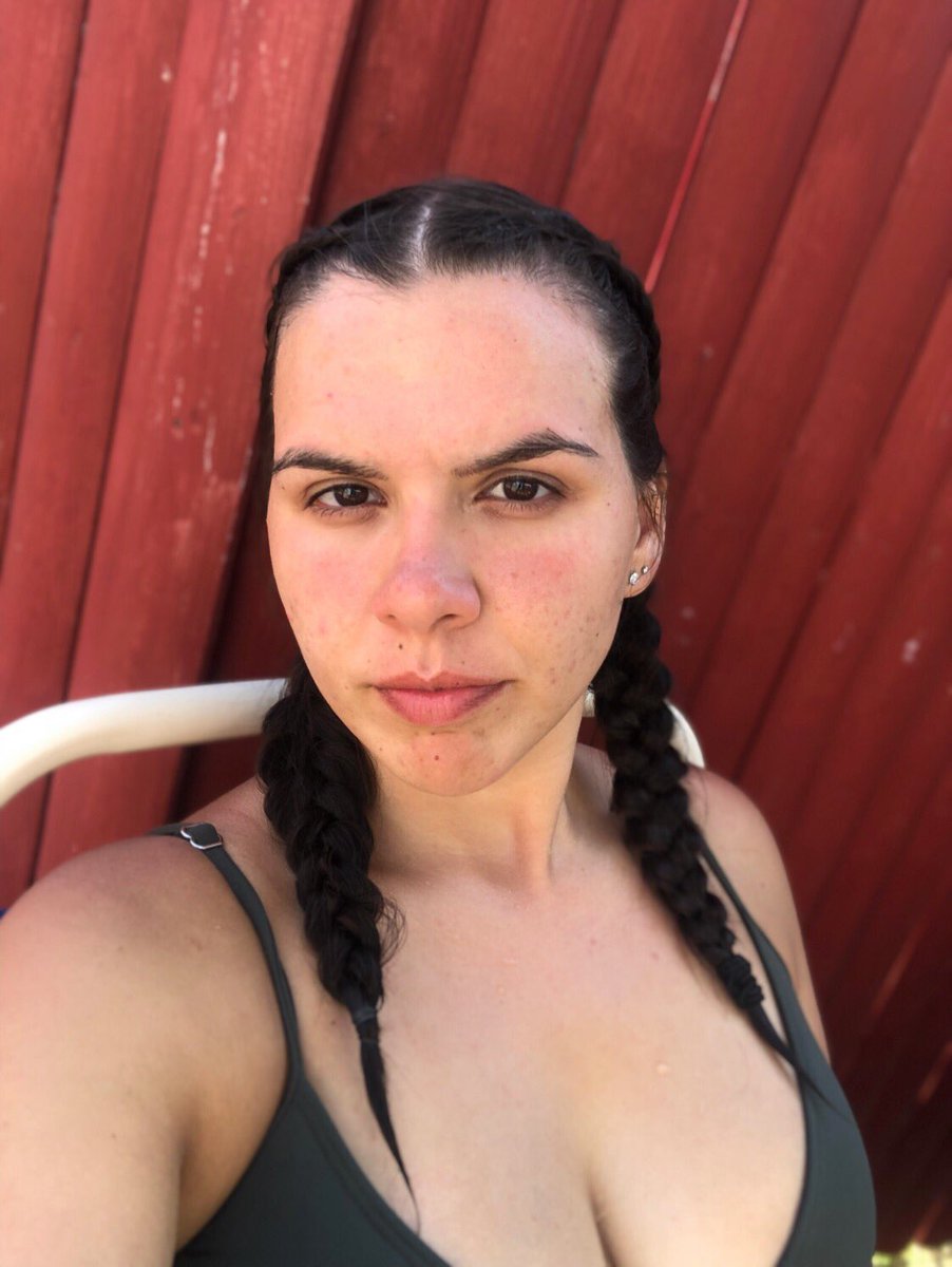 BriaMedeiros's tweet photo. Rarely ever post pictures without makeup, so here’s my natural skin, still a baddie w/ acne scars https://t.co/emT7aUzlJL