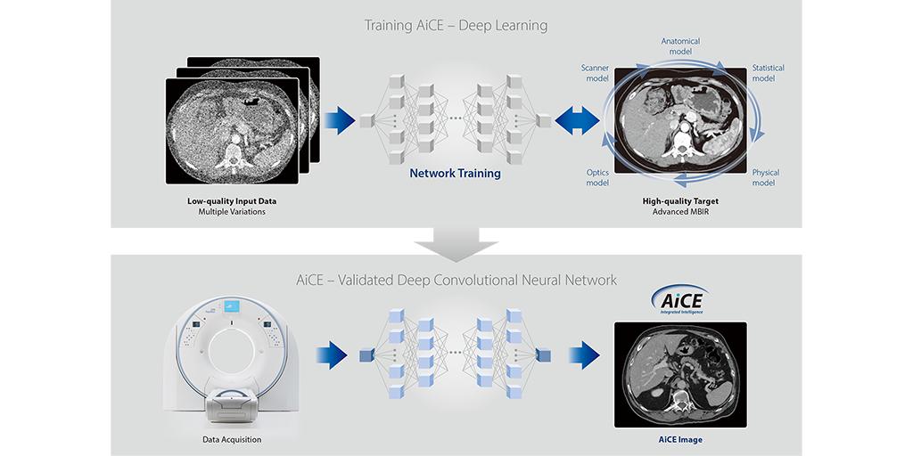 CanonMedicalANZ's tweet image. How deep learning neural network differentiates signal from noise to give extraordinarily high quality CT images while keeping the radiation dose low? Read the article bit.ly/2JzRnco Visit us at #RADAIM to learn more about #AiCE. #CollaborativeImaging. #MadePossible.