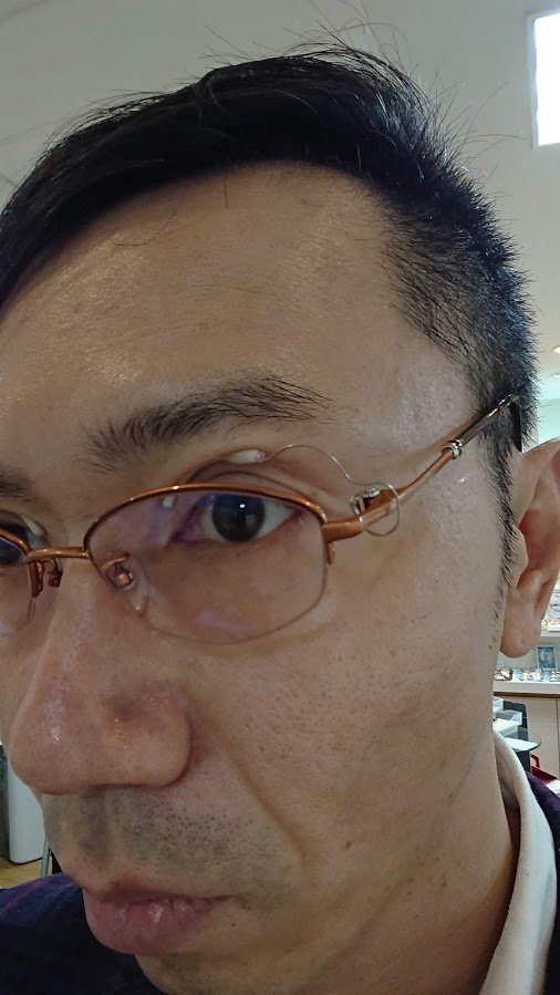 伊澤康一郎 メガネのイザワ認定眼鏡士 眼瞼下垂対策のクラッチグラスの装着イメージ 眼瞼下垂に至るには様々な要因がありますが 皆さん大変苦労されています 筋無力症 眼瞼下垂 まぶたが閉じる T Co Mam2y1xaga Twitter 伊澤康一郎 メガネのイザワ認定眼鏡士 眼瞼下垂対策のクラッチグラスの装着イメージ 眼瞼下垂に至るには様々な要因がありますが 皆さん大変苦労されています 筋無力症 眼瞼下垂 まぶたが閉じる T Co Mam2y1xaga Twitter