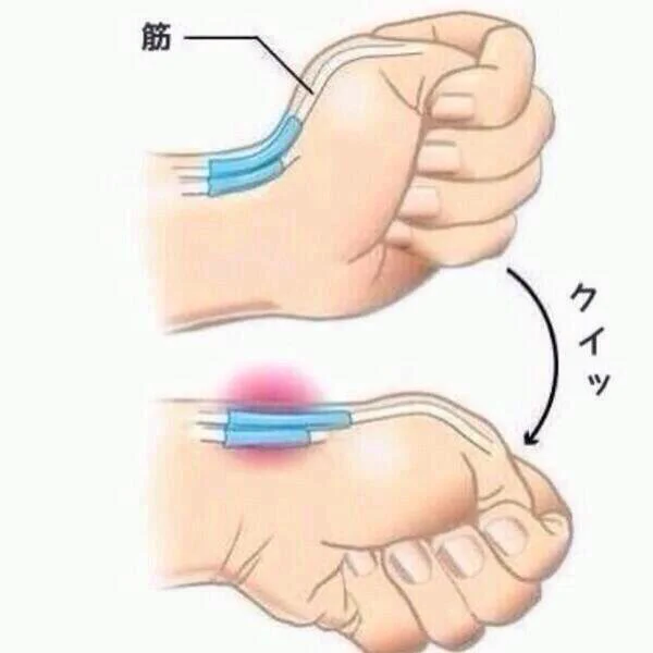 これやって痛かったらスマホ使いすぎらしい。私はかなり痛かった… 