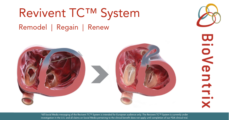 BioVentrixNL's tweet photo. Met het Revivent TC™ System kun je de onderliggende oorzaak van hartfalen meer efficiënt behandelen middels het remodelleren van de linker ventrikel. Lees meer op https://t.co/0XYIvWR1VL #ReviventTC #hartfalen https://t.co/cYeHGNWAwJ