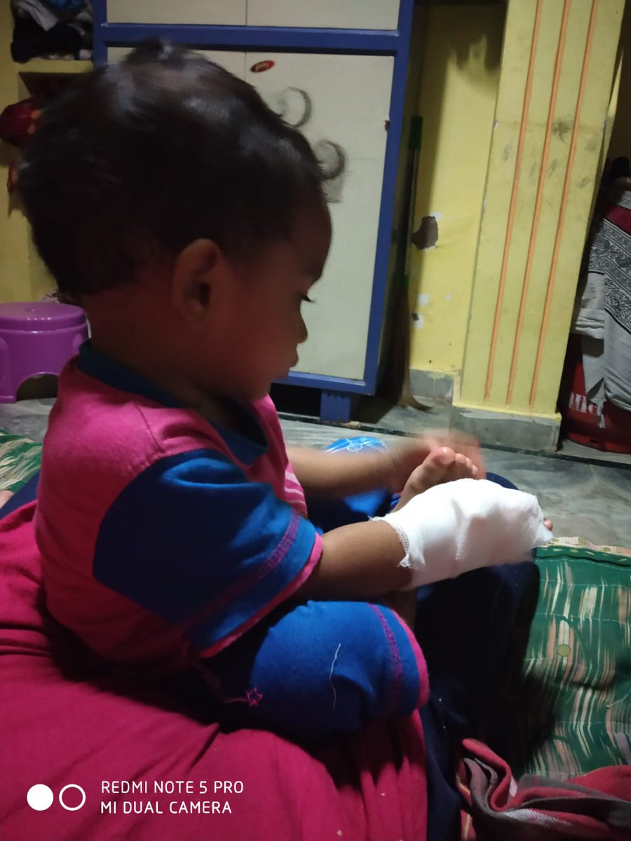 ManipalCh's tweet photo. @KTRTRS Garu ,you are the only hope 🙏
This cute little boy named Krishna Bharat is just 1 year old,but sadly  has been diagnosed with alveolar rhabdomysarcoma,a rare type of bone cancer &amp; the treatment costs a whooping 16lakhs ,which is impossible  for  their family,pls help sir https://t.co/pVTRfhDdmE