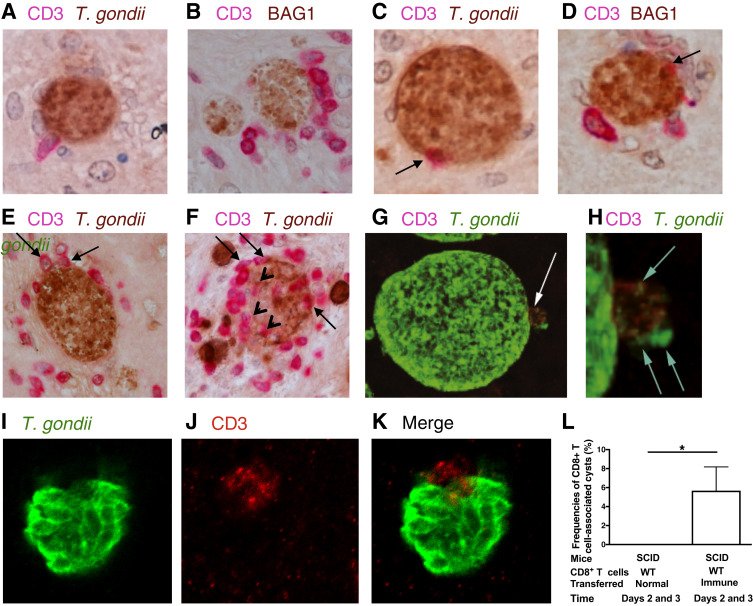 GIRCOR's tweet photo. #Toxoplasmose🐱 #immunité🛡🗡: une étude chez la #souris🐁 révèle comment les #lymphocyteT CD8+ éliminent les #kystes tissulaires volumineux du parasite #Toxoplasma gondii. Cette capacité pourrait-elle être utilisée pour lutter contre les tumeurs🦀?🤔 https://t.co/pqBaL6UQqP https://t.co/aLrjberl5C