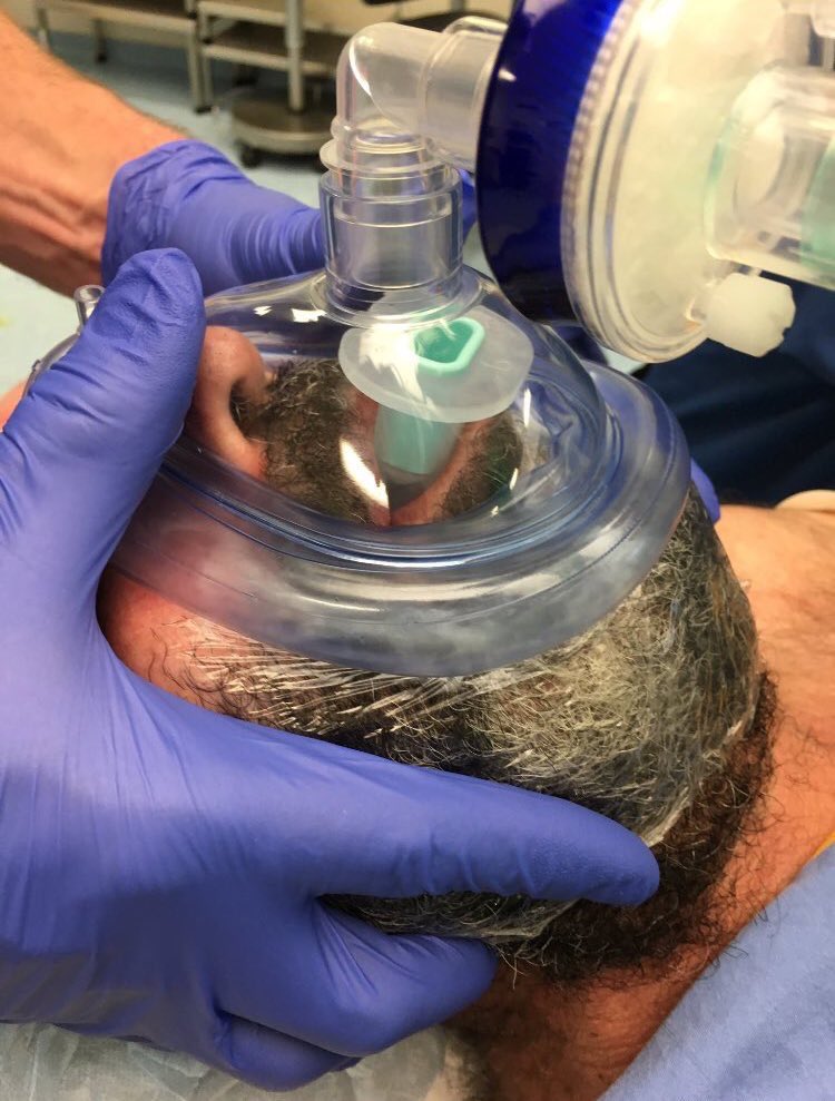 More and more patients presenting with impressively full beards for anaesthesia/airway management. Don’t forget the Tegaderm or cling-film trick if struggling to get a mask seal. #plasticisethebeard -no harm to beard #lifesaving