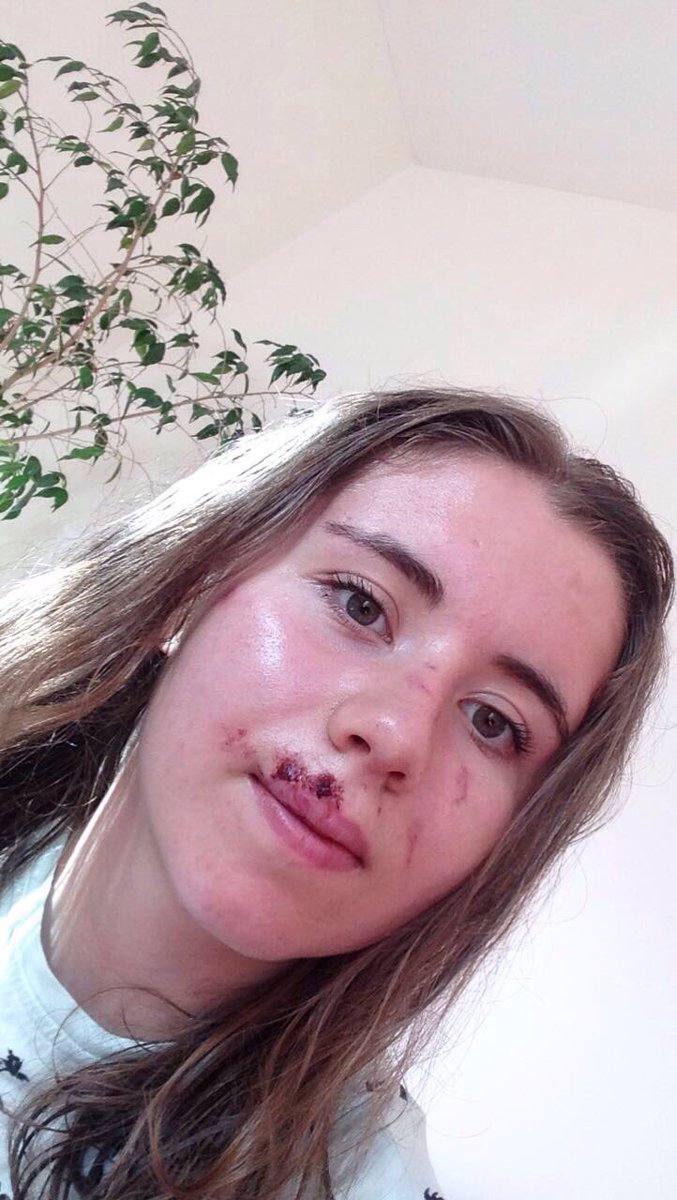 Zoe Brookes tweet media