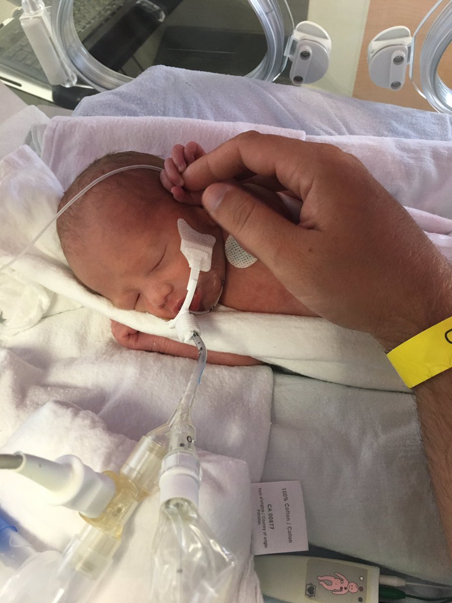MangiaficoDavid's tweet photo. Mangiafico Triplets in the NICU Downtown Toronto https://t.co/oiDjg6Da3C