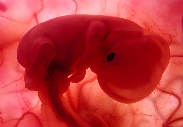 vidaparanacer's tweet photo. El ser humano en gestación, tiene derechos irrefutables por el simple hecho de ser una persona en desarrollo,no en potencia. https://t.co/i5USUeKbGb