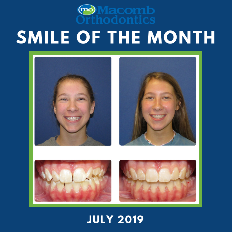 MOSmilz's tweet photo. Check out Juliana's awesome transformation into her new MO Smile! https://t.co/Lp9gWYVXsV