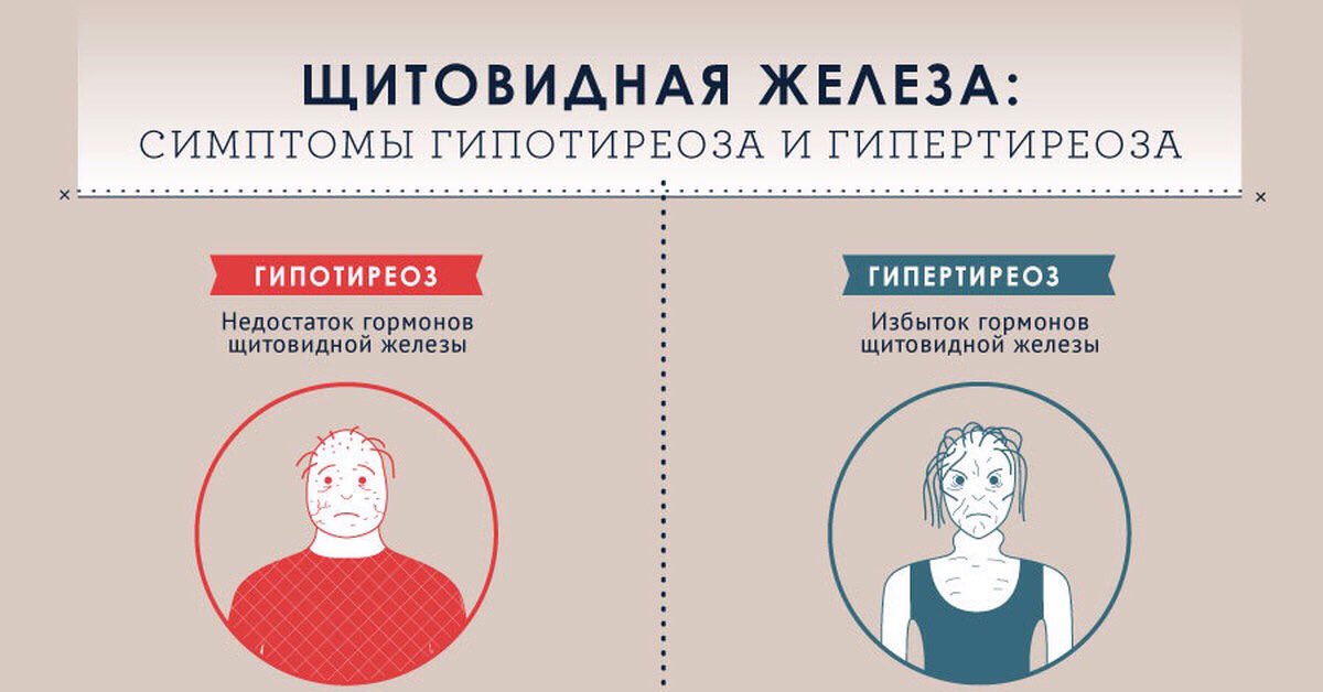 Как Похудеть При Гипотиреозе.