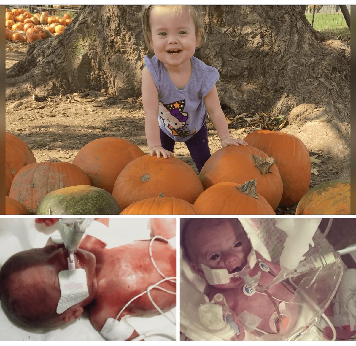 Baby Willow was born at 22 weeks and 5 days. Now she’s 4 years old.  h/t  @DSiPaint  https://flutter.nationwidechildrens.org/willow-born-at-22-weeks/