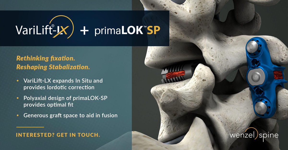 WenzelSpine's tweet photo. #simplifyspine #MIS #ASC #standalone https://t.co/8iOdiOUkxO