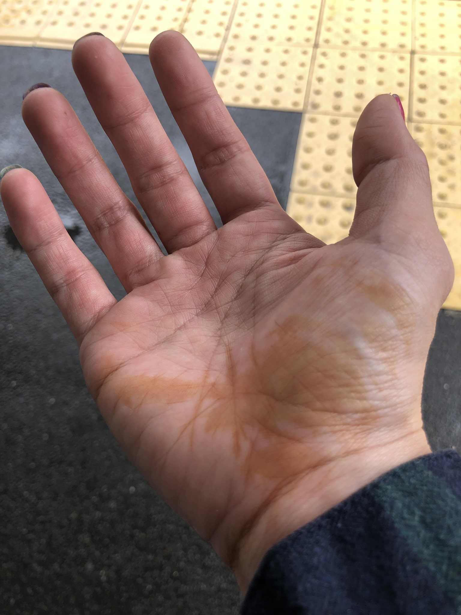 たしろさやか 朝起きたら 手のひらにシミが出来てたんですけど これは何ですか 洗っても取れませんでした イソジンこぼして ついたみたいなシミ コーヒーも 醤油も イソジンもこぼしてません ヤフー知恵袋では 知恵が足りませんでした