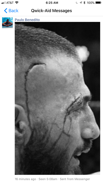 QwickAIDSports's tweet photo. Qwick-AID to the rescue.  If you plan on staying in the game you need QA. 
           STOPS Bleeding in SECONDS!

Purchase here to help a Vet:
https://t.co/4nG4wOysGT

#MMA #UFC #fighters #BOXINGNEWS #boxer https://t.co/CnchtiMPnp