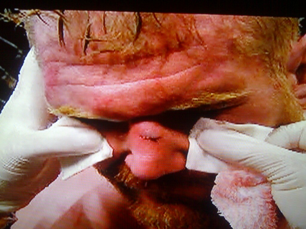 QwickAIDSports's tweet photo. Serious Bleeds need a Serious Product.  QA STOPS Bleeding in Seconds!

Add them 2 your Corner Care Kit. Ea  purchase at: https://t.co/4nG4wOgRij goes directly to COV for Paralyzed Marine LCpl Ian Delaney 
@codeofvets #ufc #PTSD #Veterans #SuicidePrevention @TheSlyStallone #boxing https://t.co/cN9ZK7cp8Y